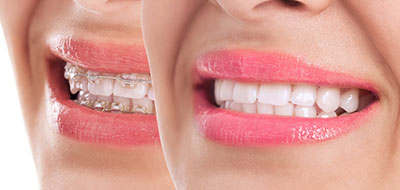 Noble Dental Studio | Ceramic Crowns, Oral Cancer Screening and All-on-4 reg 