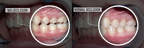 Noble Dental Studio | Dental Fillings, Oral Exams and Teeth Whitening