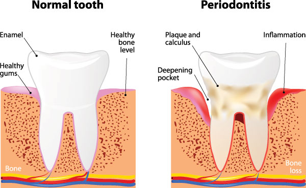 Noble Dental Studio | Laser Dentistry, Emergency Treatment and Extractions