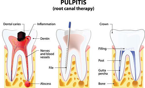 Noble Dental Studio | Oral Cancer Screening, Digital Impressions and Oral Exams